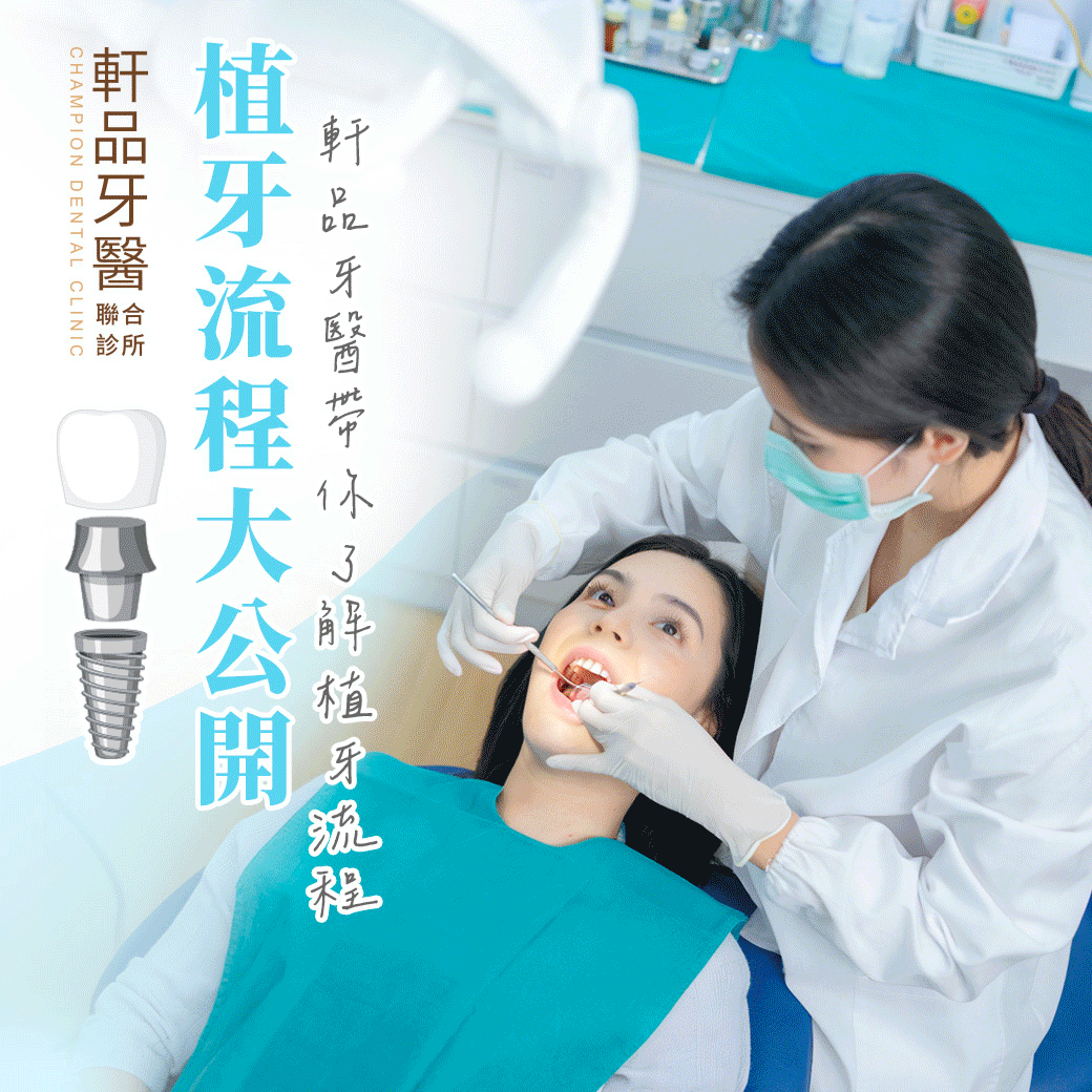 台北新北市板橋專業牙科牙醫診所推薦