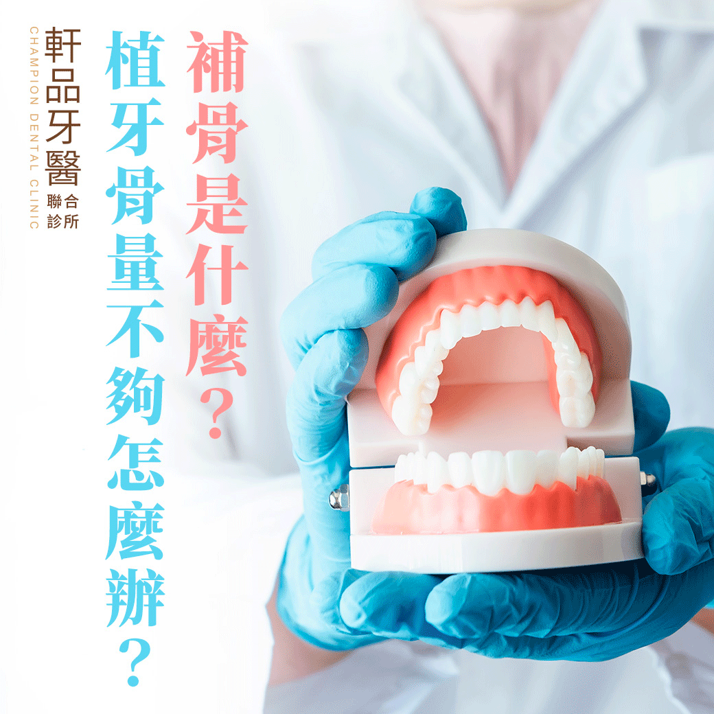 台北新北市板橋專業牙科牙醫診所推薦