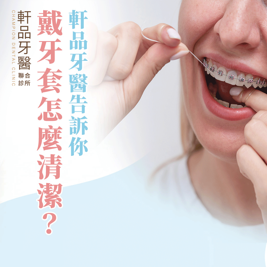 台北新北市板橋專業牙科牙醫診所推薦