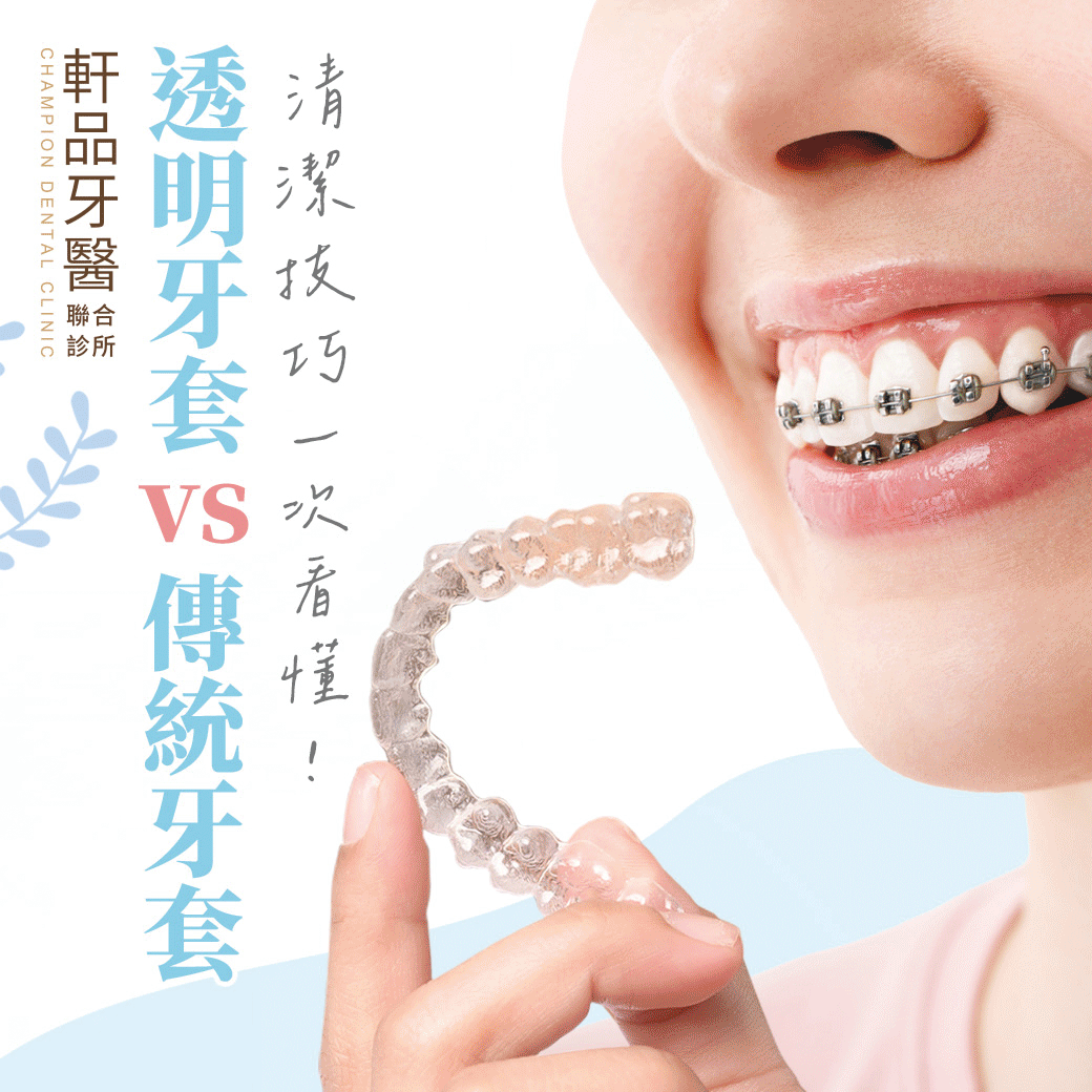 台北新北市板橋專業牙科牙醫診所推薦