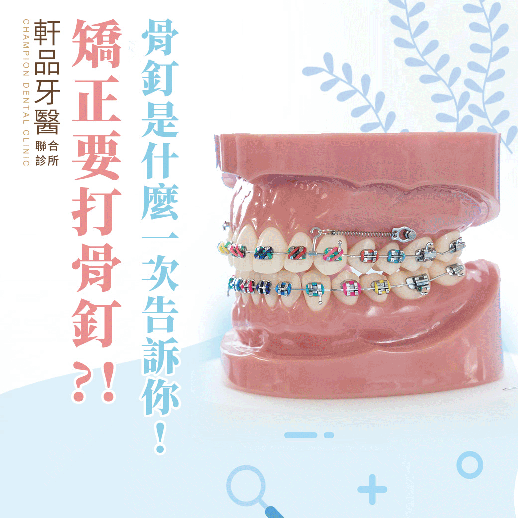 台北新北市板橋專業牙科牙醫診所推薦